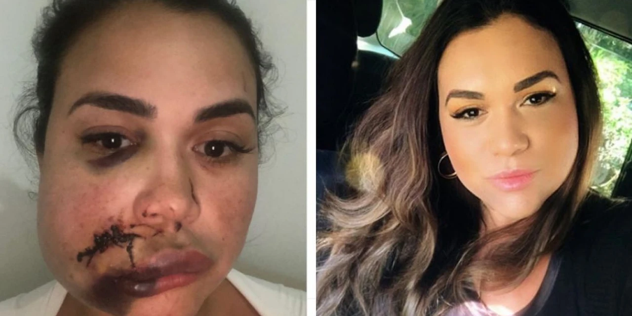 Modelo que agrediu mulher em restaurante no Jockey Club de SP disse estar arrependida e que não queria causar sofrimento à vítima