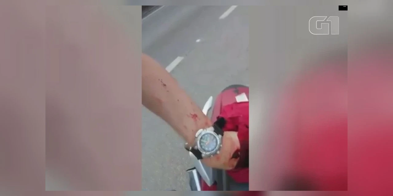 Jovem protege o pescoço com a mão e evita ser degolado por cerol em SP