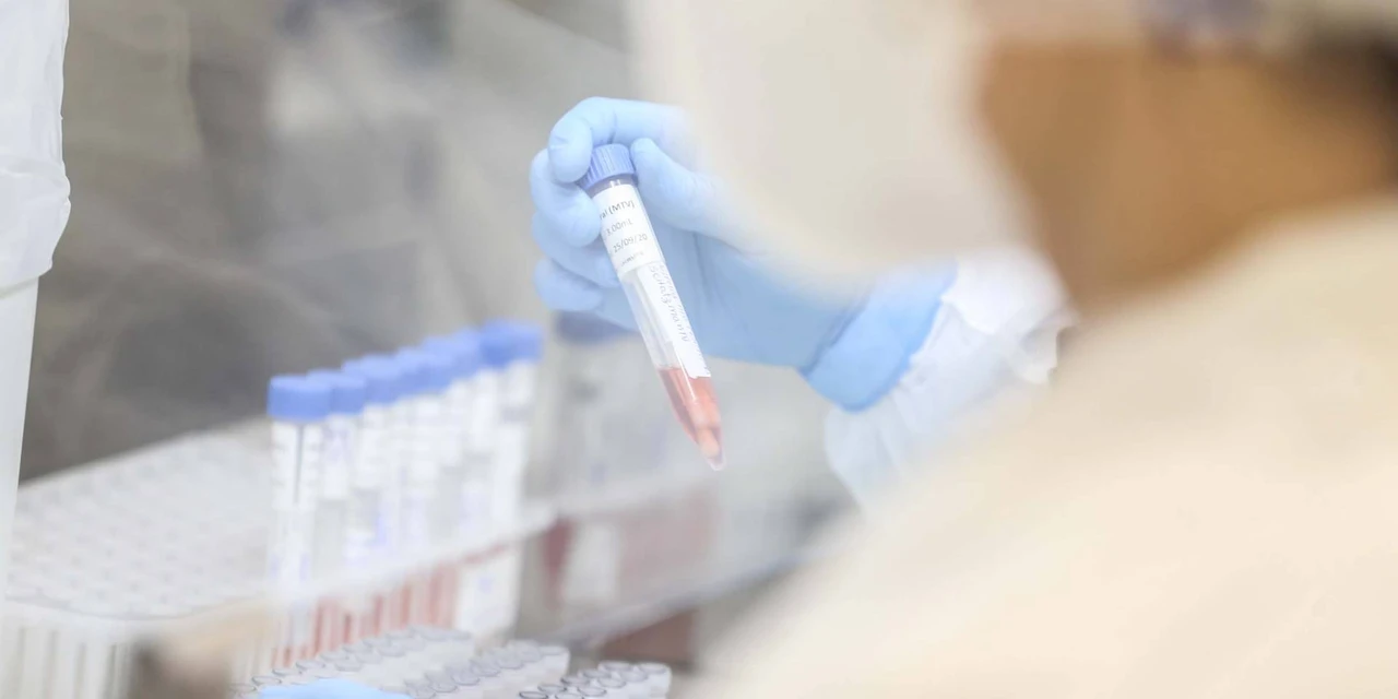 Paraná é o segundo estado que mais realiza exames RT-PCR