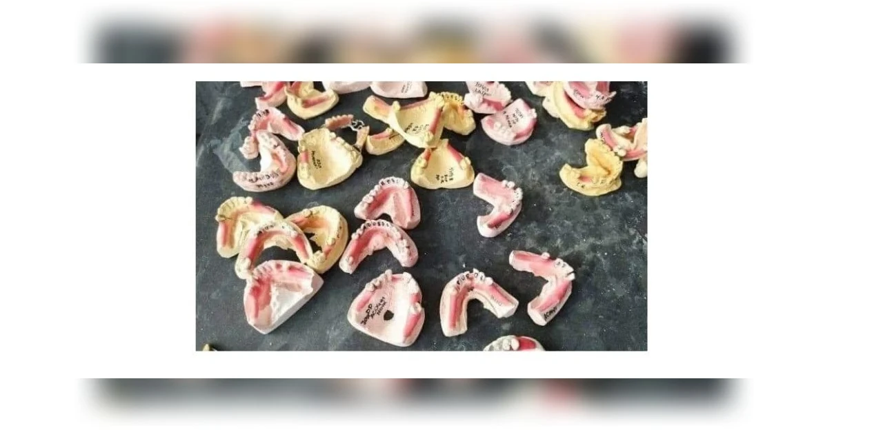 Laboratório irregular revendia próteses dentárias de cadáveres