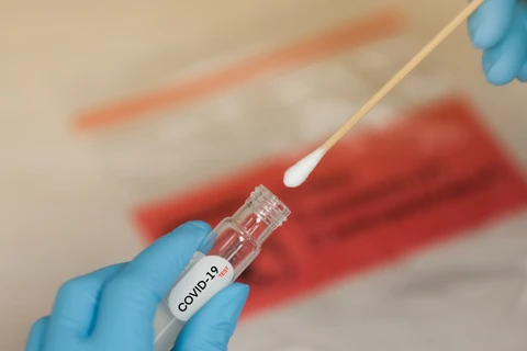 Ponta Grossa registra 185 novos casos nas últimas 24 horas