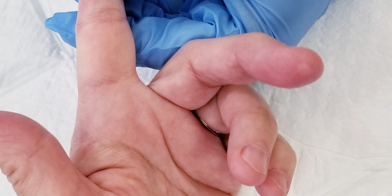 Palmeira confirma novo óbito por Covid-19 e registra mais 34 casos positivos