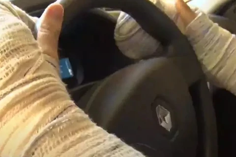 Motorista de aplicativo perde movimento das mãos após assalto, em Londrina