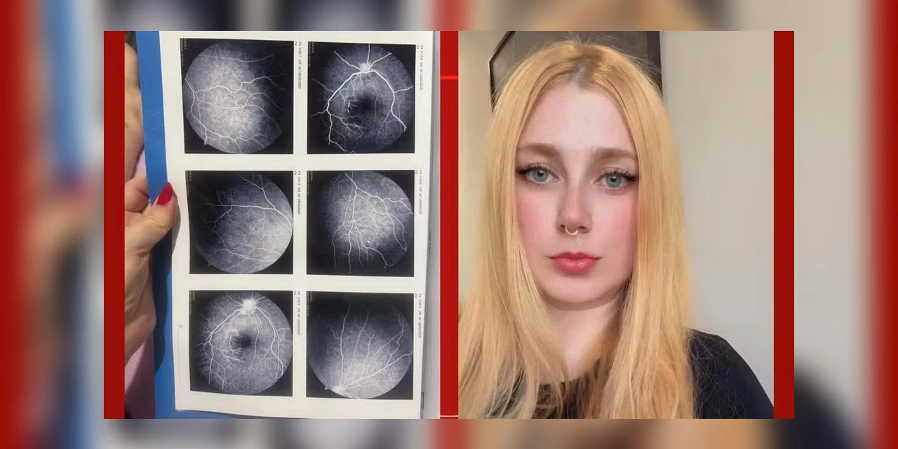 Paranaense acorda com mancha preta na visão e descobre doença rara que pode levar à cegueira: 'Pensei que fosse um cisco'